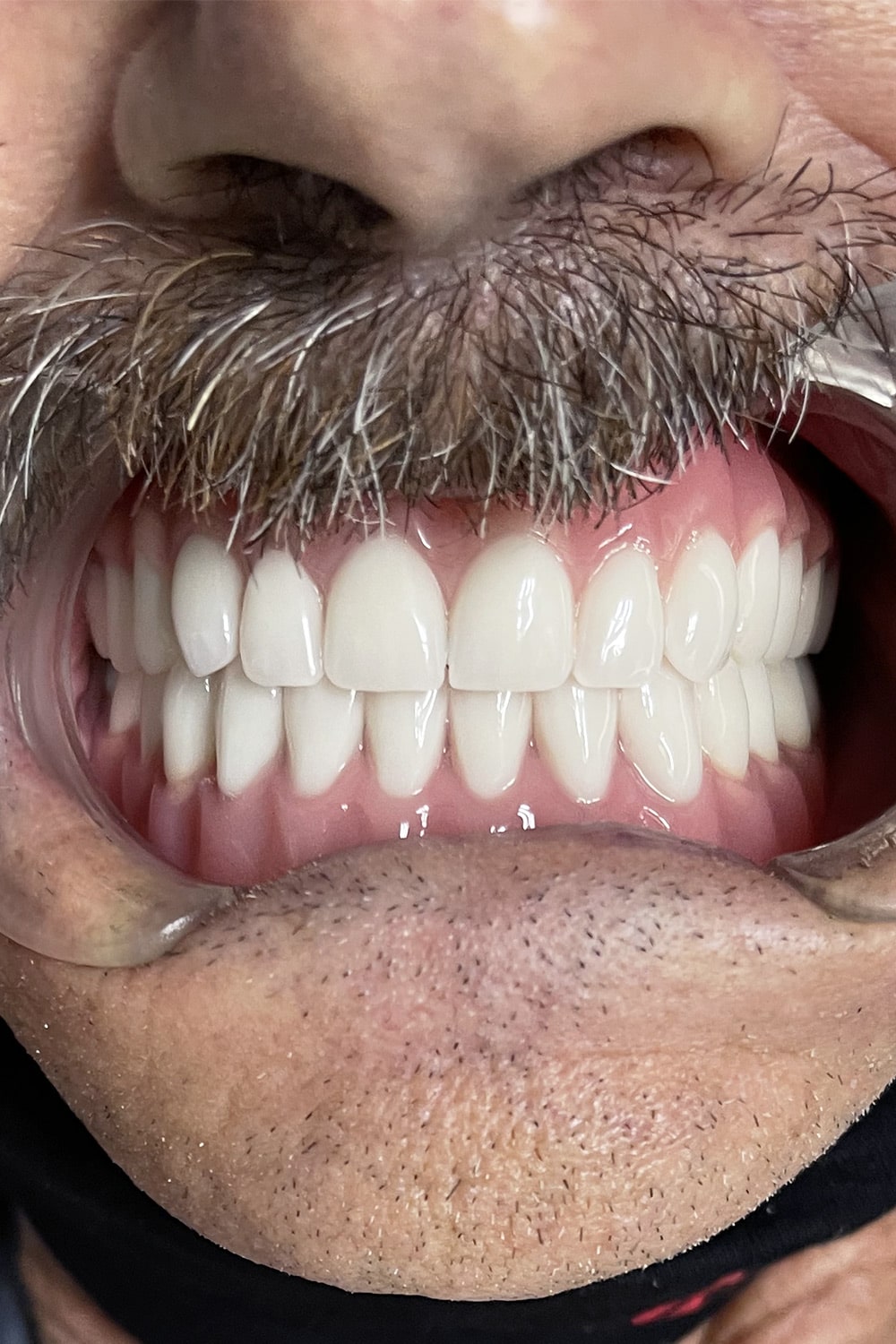 Dental Solutions Puerto Vallarta